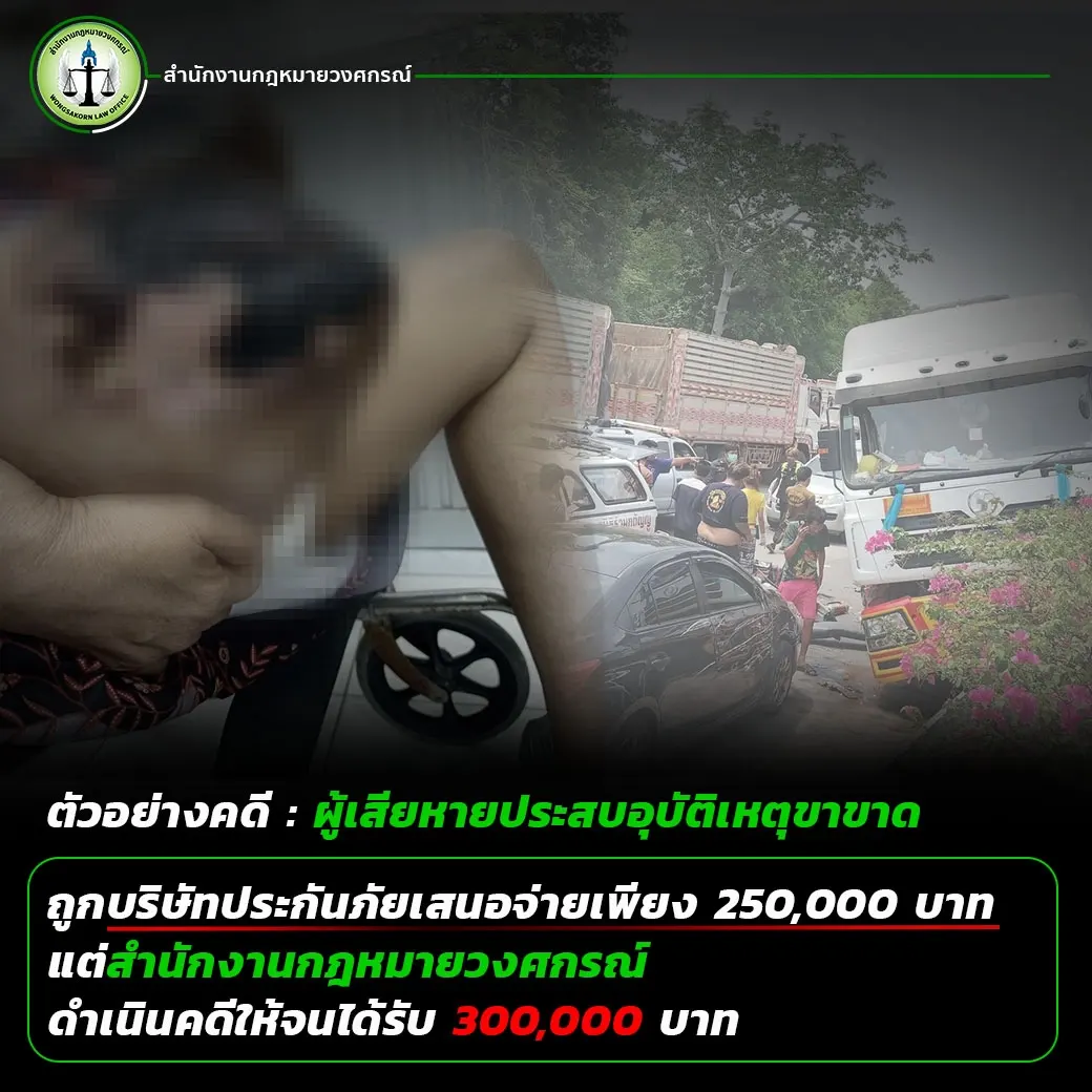 ผู้เสียหายประสบอุบัติเหตุขาขาด ถูกบริษัทประกันภัยเสนอจ่ายเพียง 250,000 บาท